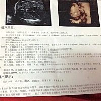 前几天刚做的四维彩超   拜托哪位懂的大神帮忙看下男女 就是很好奇想知道 谢谢啦
