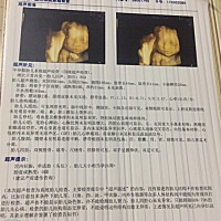 快卸货了，大家猜猜男孩还是女孩，到时候看看谁猜对了