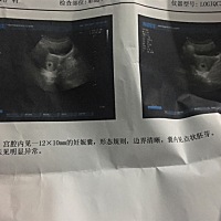 看b超单子，是女孩，还是男孩。求
