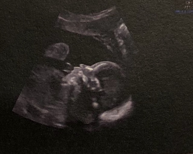 帮我看看宝宝鼻子塌不塌