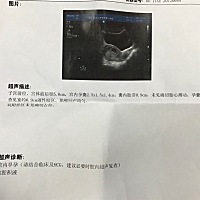 孕6w 2，还没看到胎心，很担心，😢
