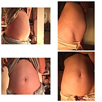 左邊的是發現後的有一天 右邊的是過兩個在拍一次 我11月份沒來 但到12月14日來 第一天一點點而已 但第二...