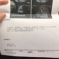 孕13 2天，能看出男宝女宝吗