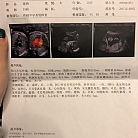 谁能算出来胎儿体重