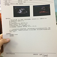 预产期2018年1月26日，今天刚好34周整。