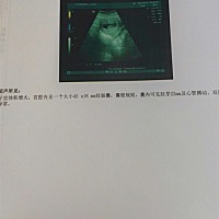 晒晒宝宝写真😄欢迎围观，第一张9周 ，第二张16周 ，第三张23周 ，马上要去拍第四张啦，期待中...