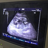 怀孕后没多久就吐，吐了一个月不吐了就特别能吃，爱吃酸甜，跟大宝口味也不一样，后来感觉胎动也不一样...