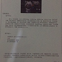 周数是按B超单，还是按预产期的，B超单现在37➕1了，预产期才35➕，好想宝宝快点发动。