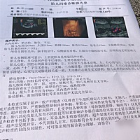 谁会看 呀👉是不是女宝宝👩