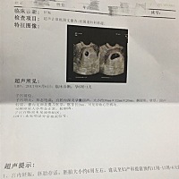 各位宝妈们，谁会看看是男宝还是女宝啊？