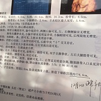 2月23号预产期，今天七个月了！之前做的四维，有会看男女的姐妹吗？