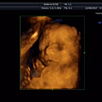 男宝还是女宝呢？好神奇！