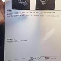 请问一下这个情况严重吗