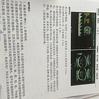 麻烦大家帮忙看下，这个是正常的吗？能看出男孩还是女孩不？