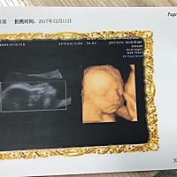 麻烦大家帮忙看看是女宝还是男宝，感谢