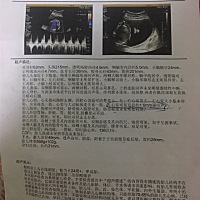 大家是怎么看男宝女宝的？