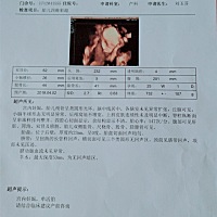 今天做了四维，感恩一切正常。担心许久的心终于放下了。