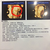 请各位有经验的同仁们，帮忙看下是男宝还是女宝，哈哈哈