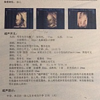 有经验的亲们麻烦帮我看下是男宝还是女宝宝呢？