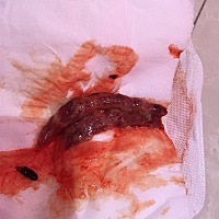 流血第五天没保住，今天下午流掉了，看着好像是两个，