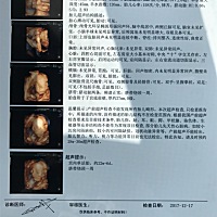 好奇男女宝宝，都想要