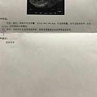 末次月经11月2日，今天48天去做B超，医生说胎芽大小正常，胎囊小，大家有这种情况吗？
