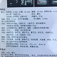 有没有经验的妈妈看看男孩还是女孩啊！