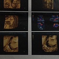 亲们，看的出男宝女宝吗