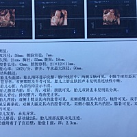 有懂的宝妈们  可以看出是男宝还是女宝的吗