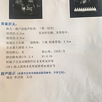 看下男孩女孩，有没有懂得宝妈