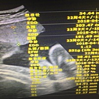四维彩超数据，这是男孩还是女孩