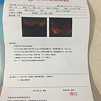 谁懂帮我看看呗