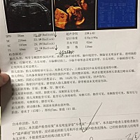 头一胎好好奇宝宝是男宝还是女宝，医生就是不给说