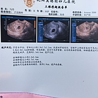 7周多有胆黄囊，没有胎心胎芽，有一样的后长出来的吗担心