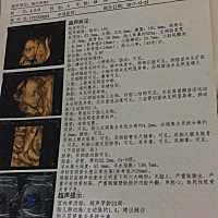 今天做了四维，有宝妈看得懂是男宝，还是女宝吗