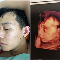 看我宝宝的四维照和宝爸像不像！没的干得时候拍了两张照片想着对比下感觉挺像的😂😂期待出生后的样...