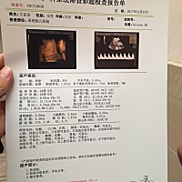 大家猜猜是男孩还是女孩^_^