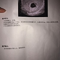 有宝妈会看男宝还是女宝吗，宝宝健不健康？谢谢🙏