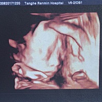 我们的第一张照片，奶奶说长得像爸爸～