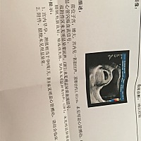 今天第二次去医院照B 超，还是一样的答案没有胎芽胎心，医生叫我要赶紧住院手术要不然就生化了，那位好...