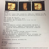 有谁会看男女的，帮忙看看