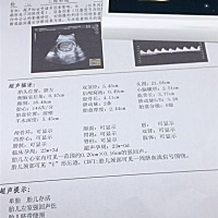 帮忙看看是男孩还是女孩 谢谢🙏