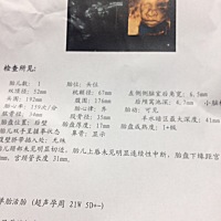 亲们，能看出是男宝宝还是女宝宝吗🤓🤓