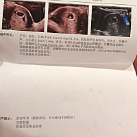 宫腔积液😭😭😭hcg和孕酮又低，继续打针和吃药，好难受，为啥会这样？