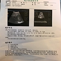 37周彩超报告，有看懂男女的宝妈帮忙看一下☺️