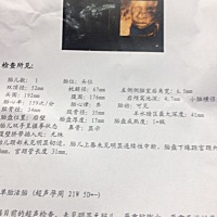 帮忙看看男娃还是女娃哈