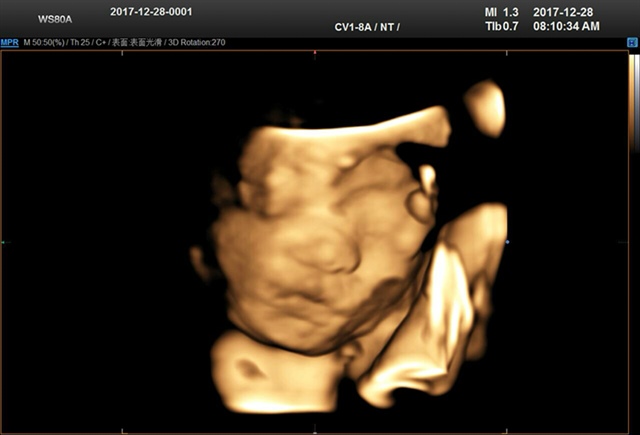 做了两天检查好动的小手终于拿了