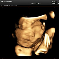 今天看见肚里宝宝(✖╹◡╹✖)♡开心，医生说是个很活跃的小孩儿，老大男孩👦🏻希望这个是女孩👧...