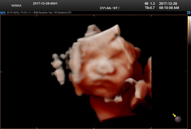 是个好动宝宝(✖╹◡╹✖)♡