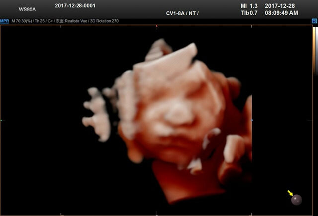 看见宝宝好开心(∩_∩)